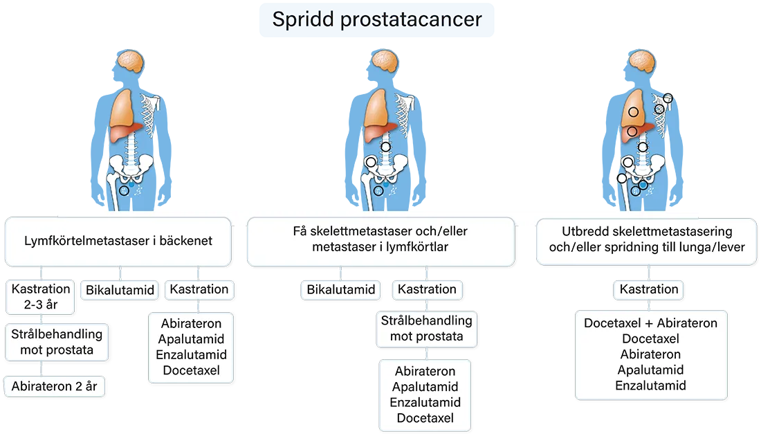 Spridd prostatacancer